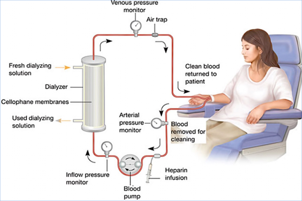 Dr.Srujal Shah - Best AV Fistula Surgeon in Ahmedabad, Gujarat, Rajasthan